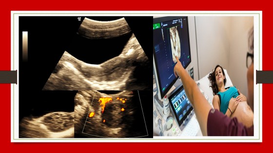 Ultrasound course training India Ultrasonography courses online