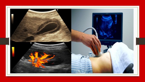 Ultrasound course training India Ultrasonography courses online