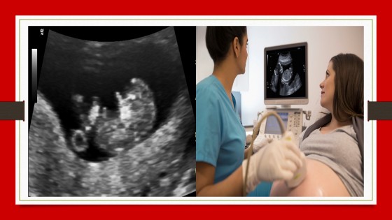 Ultrasound course training India Ultrasonography courses online