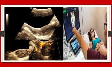 Gynecological Sonography (infertility included)