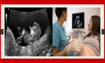 Early Pregnancy(Ectopic, level-1 Included)