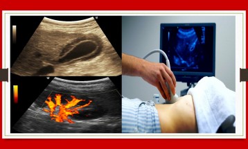 Abdominal Ultra Sonography