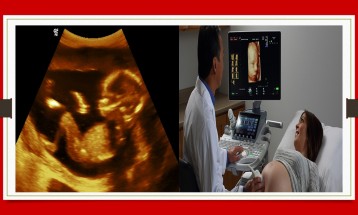 Detailed Fetal Sonography